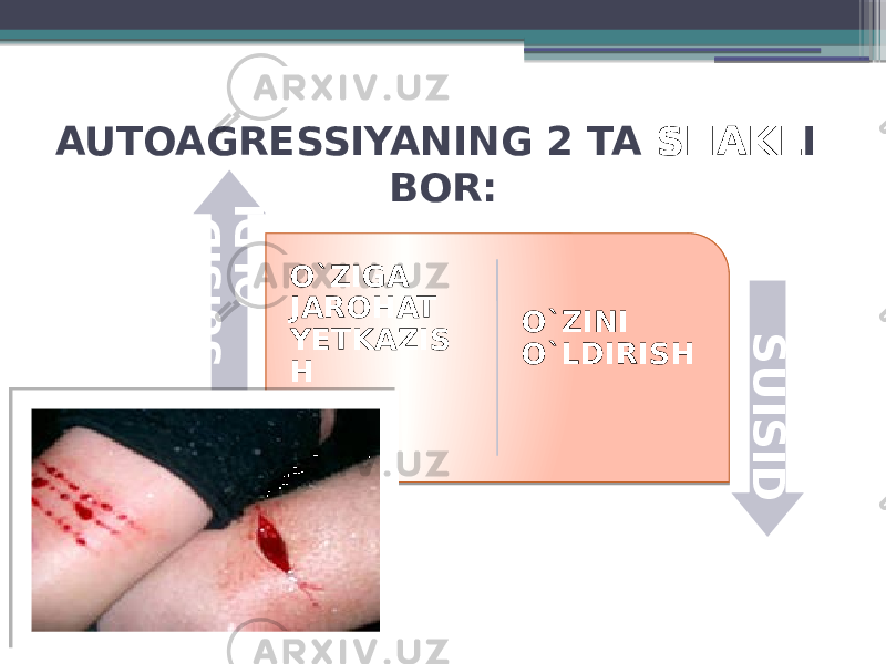 AUTOAGRESSIYANING 2 TA SHAKL I BOR: O`ZIGA JAROHAT YETKAZIS H O`ZINI O`LDIRISHS U I S I D O L D I S U I S I D 