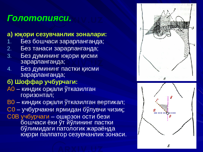 Голотопияси. а) юқори сезувчанлик зоналари: 1. Без бошчаси зарарланганда; 2. Без танаси зарарланганда; 3. Без думининг юқори қисми зарарланганда; 4. Без думининг пастки қисми зарарланганда; б) Шоффар учбурчаги: А0 – киндик орқали ўтказилган горизонтал; В0 – киндик орқали ўтказилган вертикал; С0 – учбурчакни ярмидан бўлувчи чизиқ; С0В учбурчаги – ошқозон ости бези бошчаси ёки ўт йўлининг пастки бўлимидаги патологик жараёнда юқори палпатор сезувчанлик зонаси. 