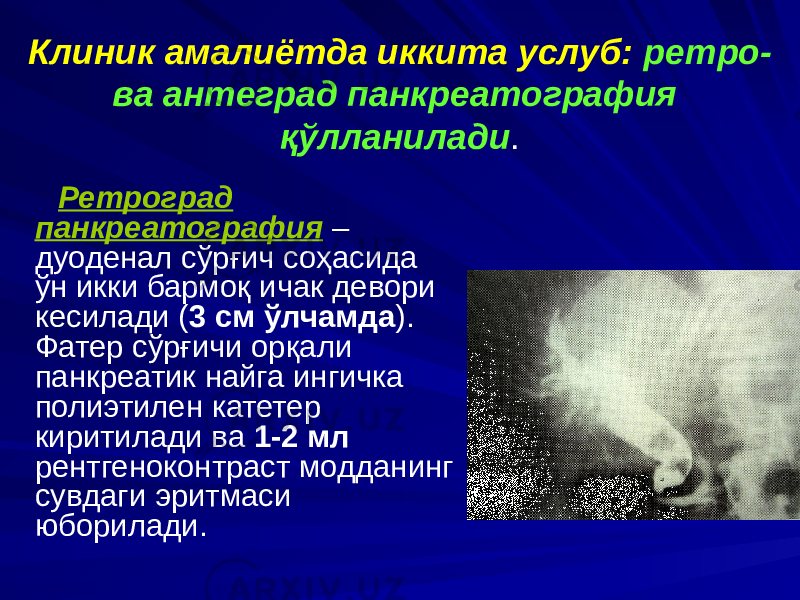 Клиник амалиётда иккита услуб: ретро- ва антеград панкреатография қўлланилади . Ретроград панкреатография – дуоденал сўрғич соҳасида ўн икки бармоқ ичак девори кесилади ( 3 см ўлчамда ). Фатер сўрғичи орқали панкреатик найга ингичка полиэтилен катетер киритилади ва 1-2 мл рентгеноконтраст модданинг сувдаги эритмаси юборилади. 