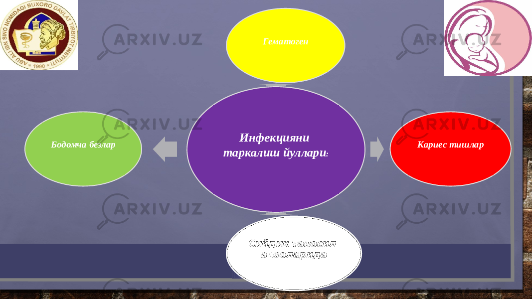 Инфекцияни таркалиш йуллари :Гематоген Кариес тишлар Сийдик таносил аъзоларидаБодомча безлар 