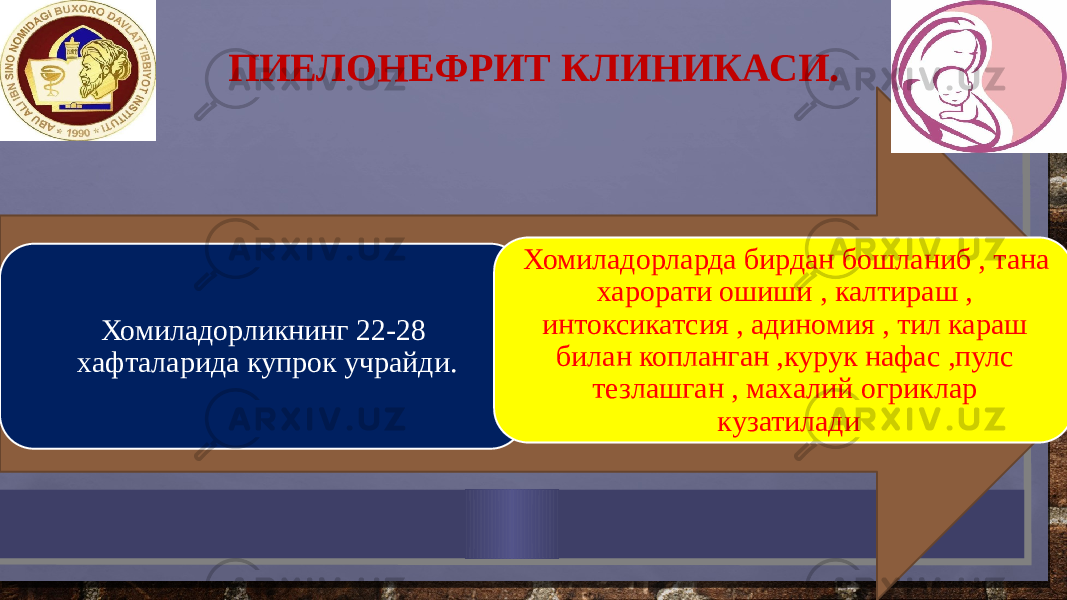 Хомиладорликнинг 22-28 хафталарида купрок учрайди. Хомиладорларда бирдан бошланиб , тана харорати ошиши , калтираш , интоксикатсия , адиномия , тил караш билан копланган ,курук нафас ,пулс тезлашган , махалий огриклар кузатиладиПИЕЛОНЕФРИТ КЛИНИКАСИ. 