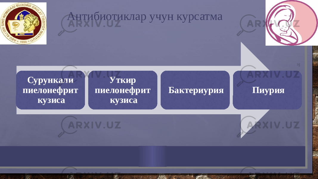 37Сурункали пиелонефрит кузиса Уткир пиелонефрит кузиса Бактериурия Пиурия Антибиотиклар учун курсатма 