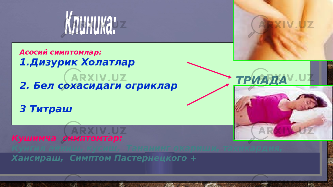 Асосий симптомлар: 1. Дизурик Холатлар 2. Бел сохасидаги огриклар 3 Титраш ТРИАДА Кушимча симптомтар: Кунгил айниш, кусиш, Тананинг окариши, тахикардия, Хансираш, Симптом Пастернецкого + 