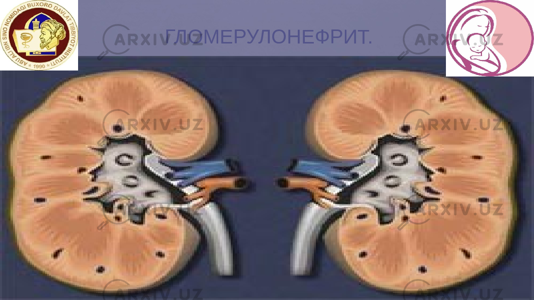  ГЛОМЕРУЛОНЕФРИТ. 