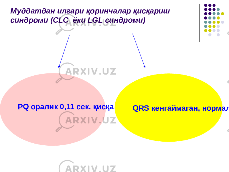 Муддатдан илгари қоринчалар қисқариш синдроми (CLC ёки LGL cиндроми) PQ оралик 0,11 сек. қисқа QRS кенгаймаган, нормал 