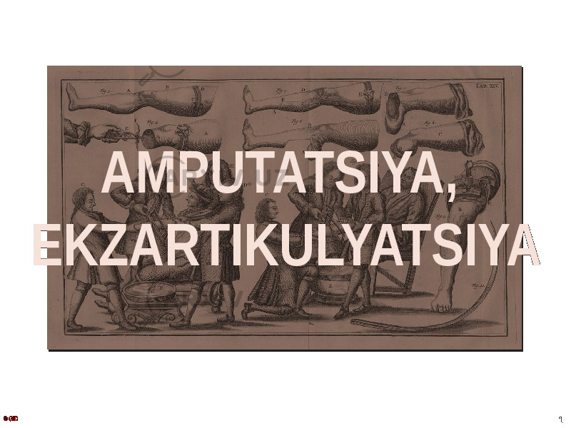 AMPUTATSIYA, EKZARTIKULYATSIYA 1© GID 