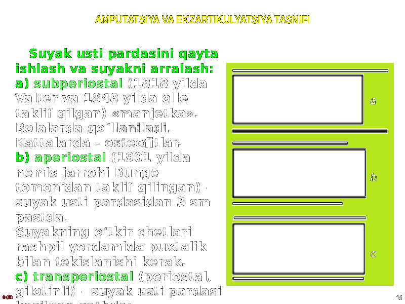 AMPUTATSIYA VA EKZARTIKULYATSIYA TASNIFI Suyak usti pardasini qayta ishlash va suyakni arralash: a) subperiostal (1818 yilda Valter va 1848 yilda olle taklif qilgan) «manjetka». Bolalarda qo ʻllaniladi. Kattalarda - osteofitlar. b) aperiostal (1901 yilda nemis jarrohi Bunge tomonidan taklif qilingan) – suyak usti pardasidan 3 sm pastda. Suyakning oʻtkir chetlari rashpil yordamida puxtalik bilan tekislanishi kerak. c) transperiostal (periostal, gilotinli) – suyak usti pardasi kesilgan sathda; © GID 16 