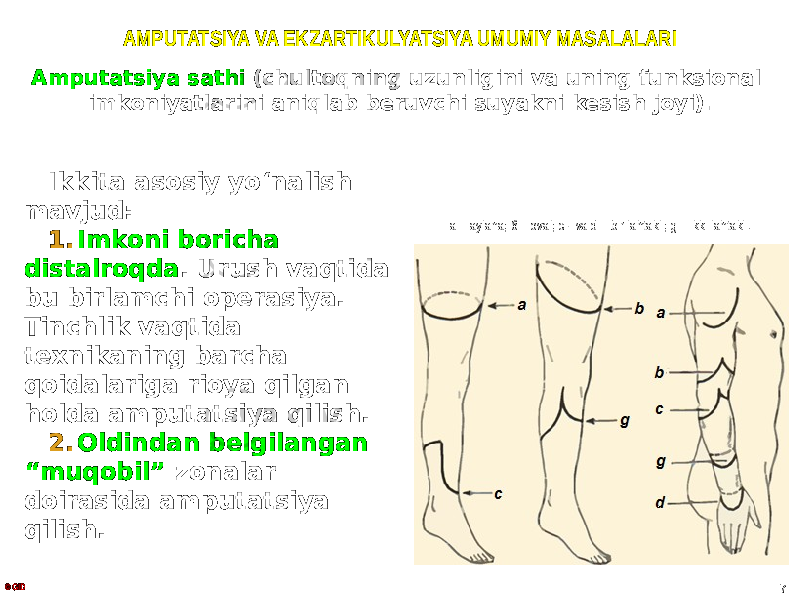 AMPUTATSIYA VA EKZARTIKULYATSIYA UMUMIY MASALALARI Amputatsiya sathi (chultoqning uzunligini va uning funksional imkoniyatlarini aniqlab beruvchi suyakni kesish joyi). © GID 7Ikkita asosiy yoʻnalish mavjud: 1. Imkoni boricha distalroqda . Urush vaqtida bu birlamchi operasiya. Tinchlik vaqtida texnikaning barcha qoidalariga rioya qilgan holda amputatsiya qilish. 2. Oldindan belgilangan “muqobil” zonalar doirasida amputatsiya qilish. a – aylana; б – oval; c - va d – bir lahtakli; g – ikki lahtakli. 