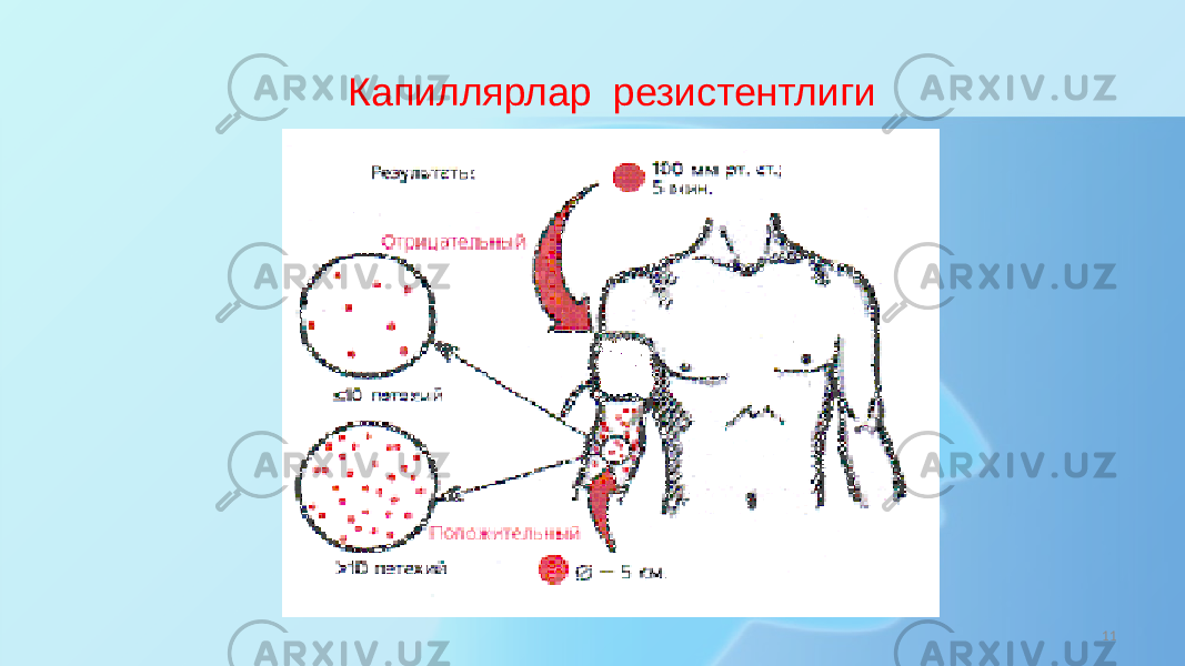 11Капиллярлар резистентлиги 