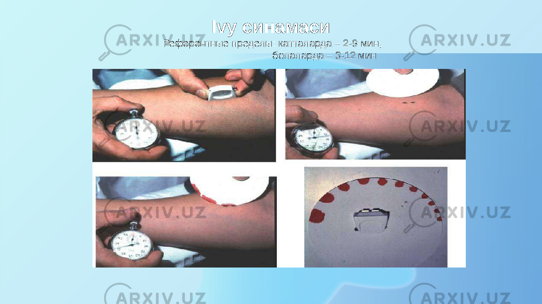 Ivy синамаси Референтные пределы: катталарда – 2-9 мин, болаларда – 3-12 мин 