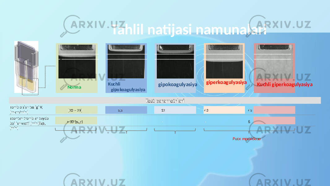 Norma gipokoagulyasiya giperkoagulyasiya Kuchli giperkoagulyasiya Tomb o&#39;sish tezligi V, [mkm/min ] spontan tromblar paydo bo`lish vaqti [min] Tsp , [min] Test parametrlariKuchli gipokoagulyasiya [20 – 29] 5,5 12 43 45 > 30 (yuq) ‐ ‐ ‐ 8Tahlil natijasi namunalari Риск тромбоза 