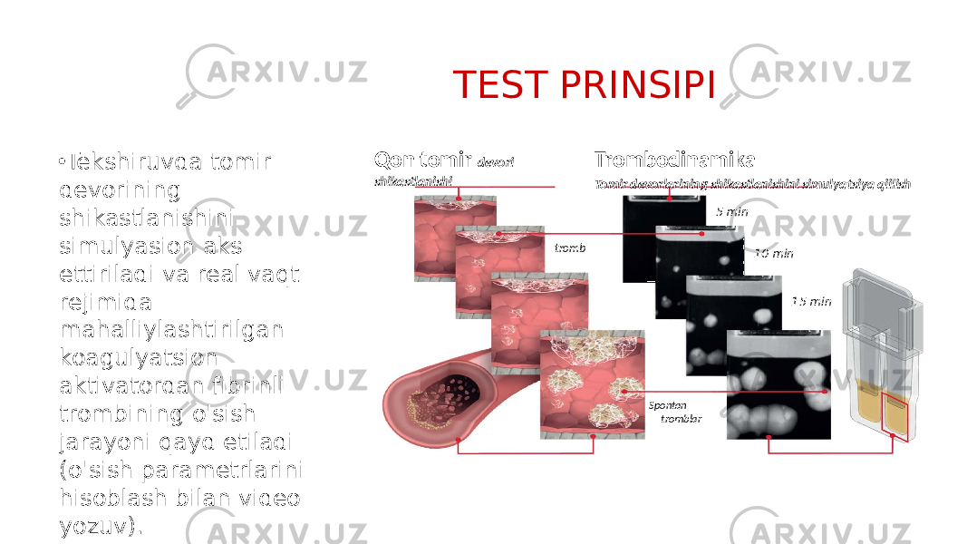 • Tekshiruvda tomir devorining shikastlanishini simulyasion aks ettiriladi va real vaqt rejimida mahalliylashtirilgan koagulyatsion aktivatordan fibrinli trombining o&#39;sish jarayoni qayd etiladi (o&#39;sish parametrlarini hisoblash bilan video yozuv). TEST PRINSIPI Qon tomir devori shikastlanishi Trombodinamika Tomir devorlarining shikastlanishini simulyatsiya qiilish 5 min 10 min 15 mintromb Spontan tromblar 