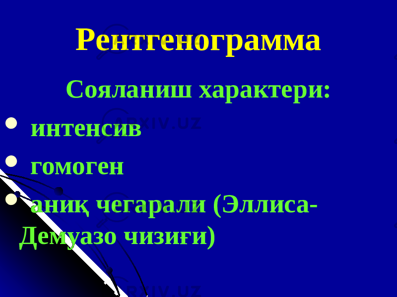 Рентгенограмма Сояланиш характери:  интенсив  гомоген  ани қ чегарали (Эллиса- Демуазо чизиғи) 