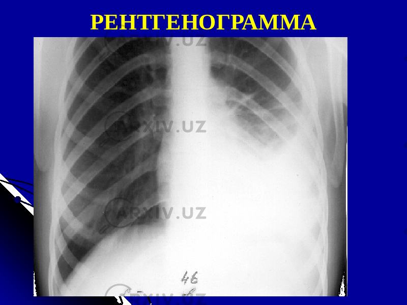 РЕНТГЕНОГРАММА 