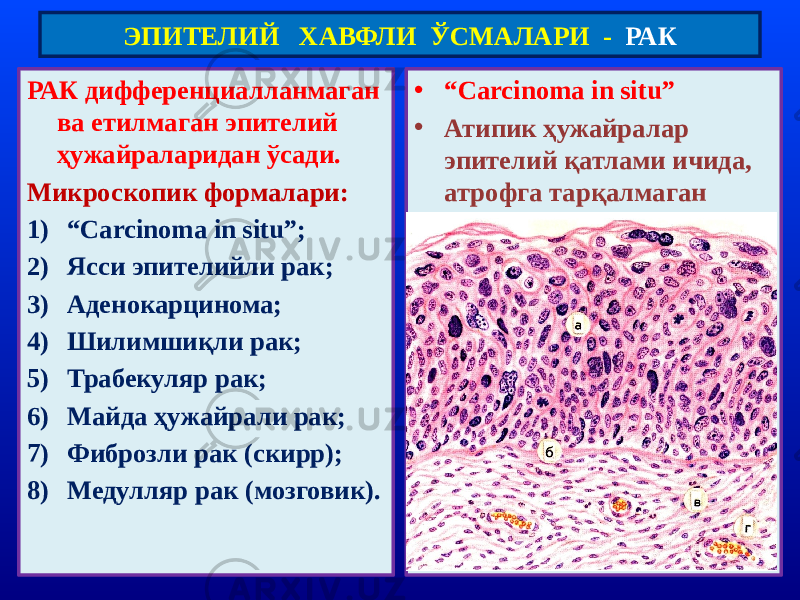 РАК дифференциалланмаган ва етилмаган эпителий ҳужайраларидан ўсади. Микроскопик формалари: 1) “ Carcinoma in situ”; 2) Ясси эпителийли рак; 3) Аденокарцинома; 4) Шилимшиқли рак; 5) Трабекуляр рак; 6) Майда ҳужайрали рак; 7) Фиброзли рак (скирр); 8) Медулляр рак (мозговик). • “ Carcinoma in situ” • Атипик ҳужайралар эпителий қатлами ичида, атрофга тарқалмаганЭПИТЕЛИЙ ХАВФЛИ ЎСМАЛАРИ - РАК 