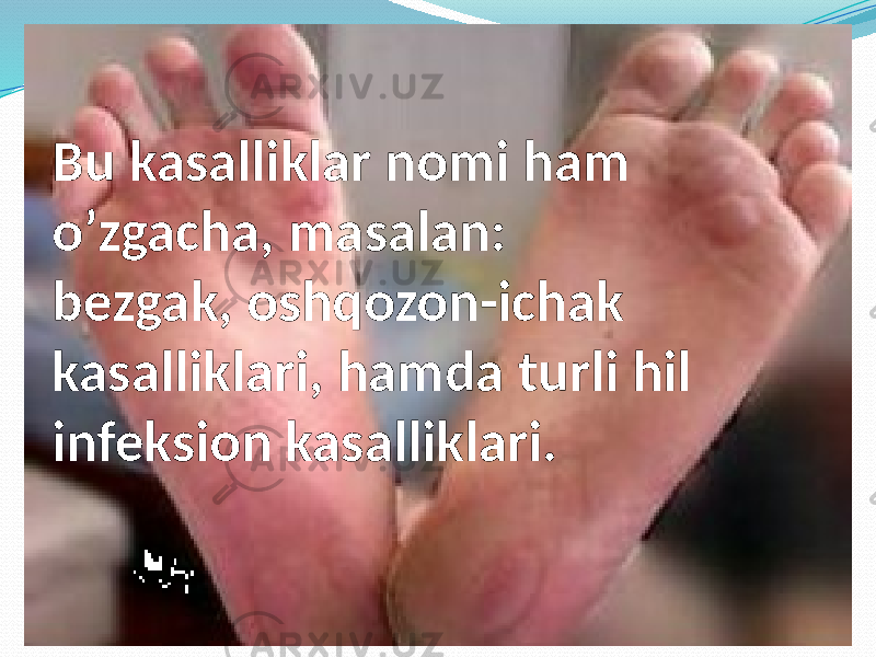 Bu kasalliklar nomi ham o’zgacha, masalan: bezgak, oshqozon-ichak kasalliklari, hamda turli hil infeksion kasalliklari. 