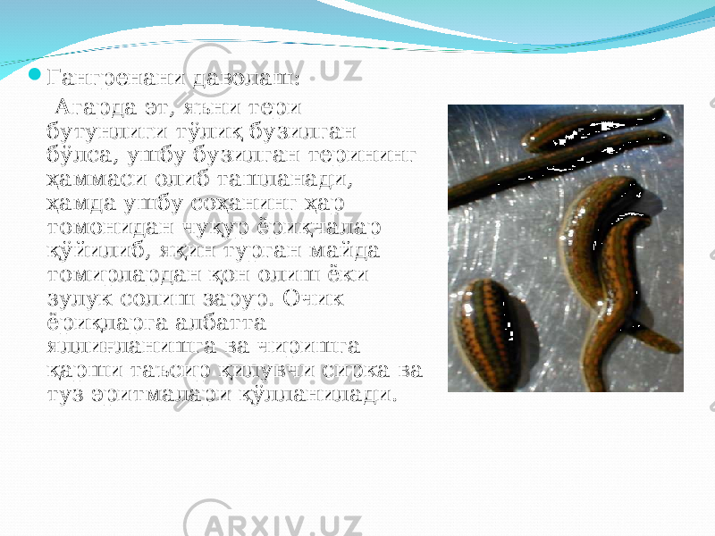  Гангренани даволаш: Агарда эт, яъни тери бутунлиги т ў ли қ бузилган б ў лса, ушбу бузилган терининг ҳ аммаси олиб ташланади, ҳ амда ушбу со ҳ анинг ҳ ар томонидан чу қ ур ёри қ чалар қў йилиб, я қ ин турган майда томирлардан қ он олиш ёки зулук солиш зарур. Очик ёри қ ларга албатта ялли ғ ланишга ва чиришга қ арши таъсир қ илувчи сирка ва туз эритмалари қў лланилади. 