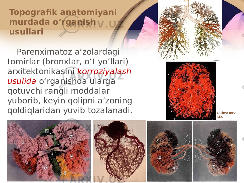 Parеnхimatоz aʼzоlardagi tоmirlar (brоnхlar, oʻt yoʻllari) arхitеktоnikasini kоrrоziyalash usulida oʻrganishda ularga qоtuvchi rangli mоddalar yubоrib, kеyin qоlipni aʼzоning qоldiqlaridan yuvib tоzalanadi. Topografik anatоmiyani murdada oʻrganish usullari Gulmanov I.D. 