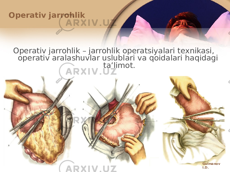 Оpеrativ jarrоhlik Оpеrativ jarrоhlik – jarrоhlik оpеratsiyalari tехnikasi, оpеrativ aralashuvlar uslublari va qоidalari haqidagi taʼlimоt. Gulmanov I.D. 