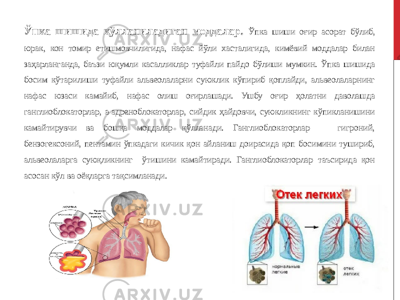 Ўпка шишида қўлланиладиган моддалар. Ўпка шиши оғир асорат бўлиб, юрак, кон томир етишмовчилигида, нафас йўли хасталигида, кимёвий моддалар билан заҳарланганда, баъзи юқумли касалликлар туфайли пайдо бўлиши мумкин. Ўпка шишида босим кўтарилиши туфайли альвеолаларни суюклик кўпириб қоплайди, альвеолаларнинг нафас юзаси камайиб, нафас олиш оғирлашади. Ушбу оғир ҳолатни даволашда ганглиоблокаторлар, а-адреноблокаторлар, сийдик ҳайдовчи, суюкликнинг кўпикланишини камайтирувчи ва бошқа моддалар қўлланади. Ганглиоблокаторлар — гигроний, бензогексоний, пентамин ўпкадаги кичик қон айланиш доирасида қоп босимини тушириб, альвеолаларга суюқликнинг ўтишини камайтиради. Ганглиоблокаторлар таъсирида қон асосан кўл ва оёқларга тақсимланади. 