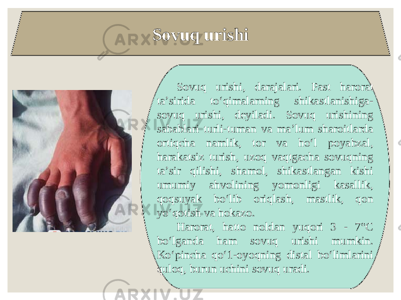 Sovuq urishi Sovuq urishi, darajalari. Past harorat ta’sirida to‘qimalarning shikastlanishiga- sovuq urishi, deyiladi. Sovuq urishining sabablari turli-tuman va ma’lum sharoitlarda ortiqcha namlik, tor va ho‘l poyabzal, harakatsiz turish, uzoq vaqtgacha sovuqning ta’sir qilishi, shamol, shikastlangan kishi umumiy ahvolining yomonligi kasallik, qoqsuyak bo‘lib oriqlash, mastlik, qon yo‘qotish va hokazo. Harorat, hatto noldan yuqori 3 - 7°C bo‘lganda ham sovuq urishi mumkin. Ko‘pincha qo‘1-oyoqning distal bo‘limlarini quloq, burun uchini sovuq uradi. 