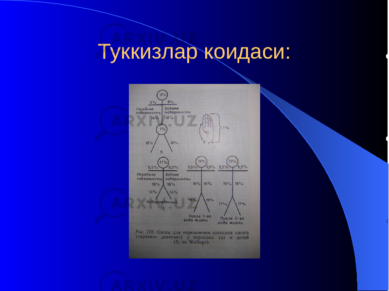 Туккизлар коидаси: 