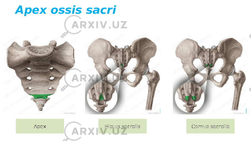 Apex ossis sacri Cornua sacraliaHiatus sacralisApex 