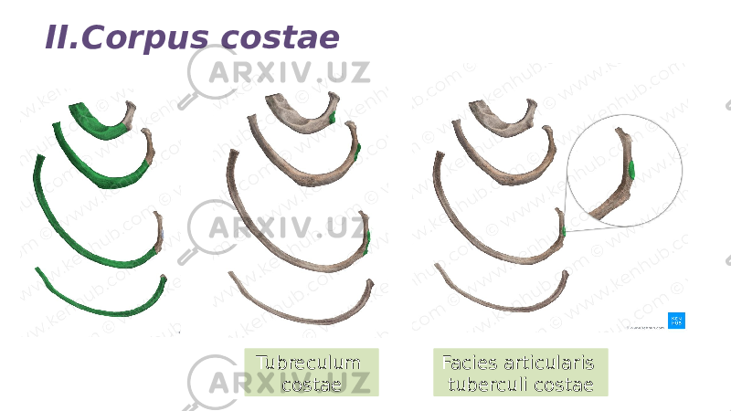 II.Corpus costae Tubreculum costae Facies articularis tuberculi costae 