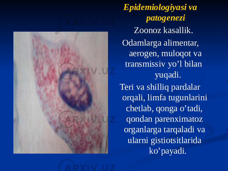 Epidemiologiyasi va patogenezi Zoonoz kasallik. Odamlarga alimentar, aerogen, muloqot va transmissiv yoʼl bilan yuqadi. Teri va shilliq pardalar orqali, limfa tugunlarini chetlab, qonga oʼtadi, qondan parenximatoz organlarga tarqaladi va ularni gistiotsitlarida koʼpayadi. 