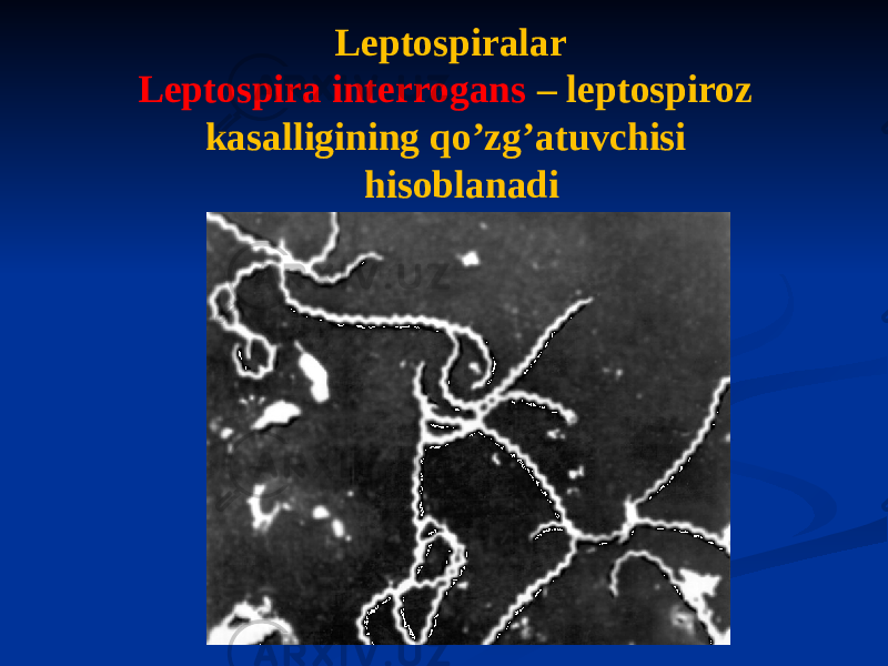 Leptospiralar Leptospira interrogans – leptospiroz kasalligining qoʼzgʼatuvchisi hisoblanadi 