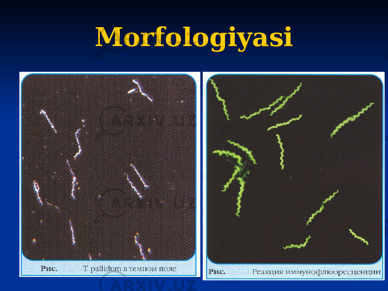 Morfologiyasi 