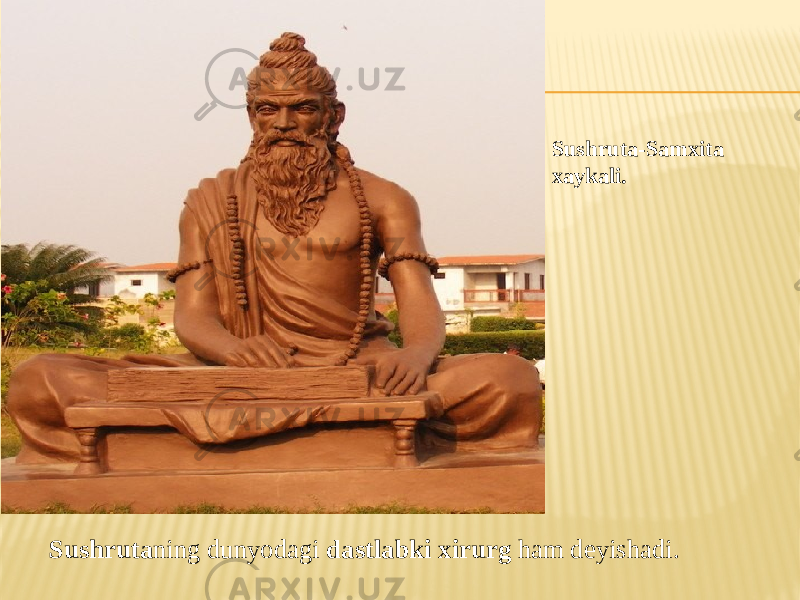  Sushruta ning dunyodagi dastlabki xirurg ham deyishadi. Sushruta-Samxita xaykali. 
