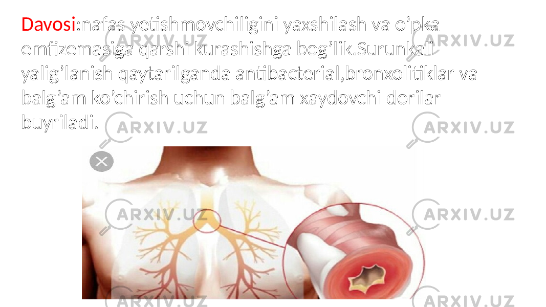 Davosi :nafas yetishmovchiligini yaxshilash va o’pka emfizemasiga qarshi kurashishga bog’lik.Surunkali yalig’lanish qaytarilganda antibacterial,bronxolitiklar va balg’am ko’chirish uchun balg’am xaydovchi dorilar buyriladi. 