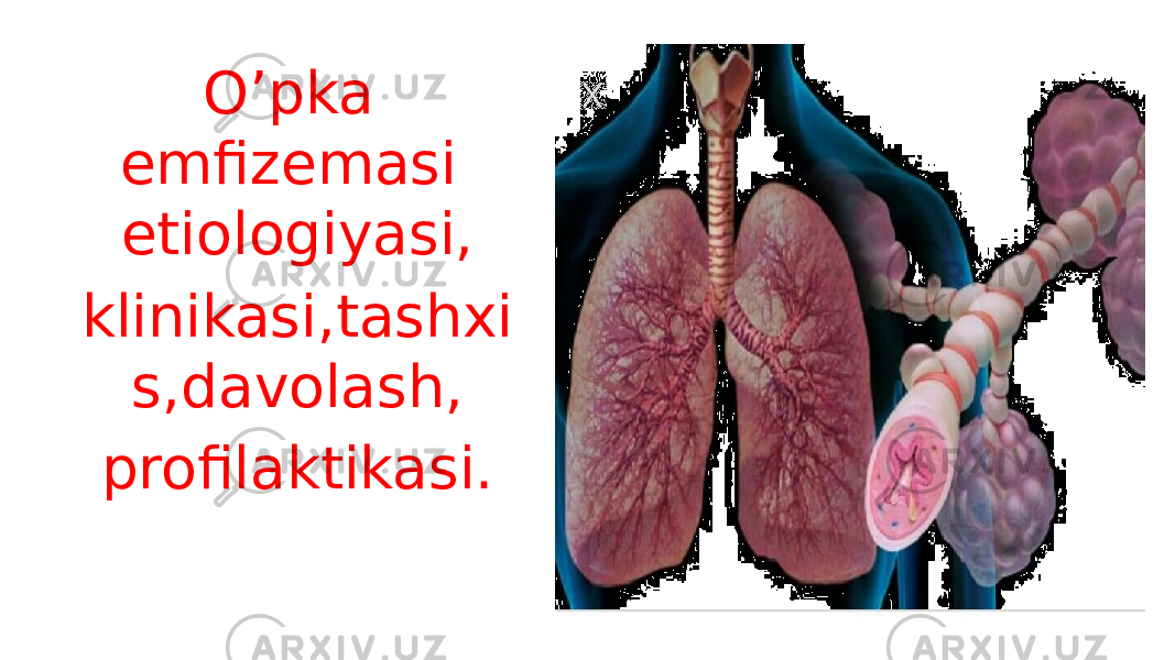 O’pka emfizemasi etiologiyasi, klinikasi,tashxi s,davolash, profilaktikasi. 