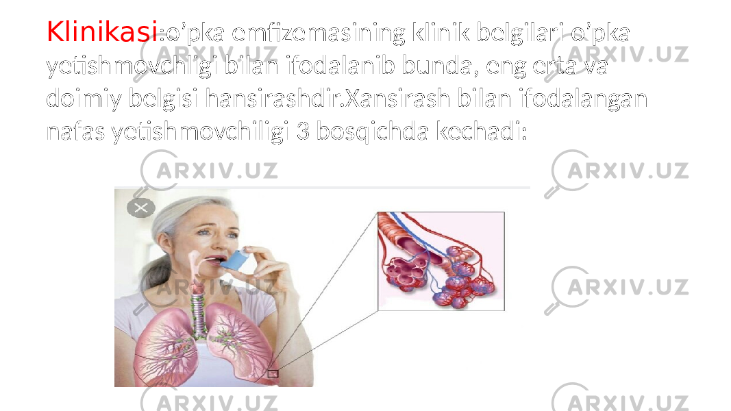 Klinikasi :o’pka emfizemasining klinik belgilari o’pka yetishmovchligi bilan ifodalanib bunda, eng erta va doimiy belgisi hansirashdir.Xansirash bilan ifodalangan nafas yetishmovchiligi 3 bosqichda kechadi: 