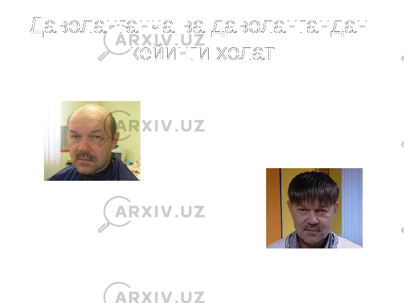 Даволанганча ва даволангандан кейинги холат 