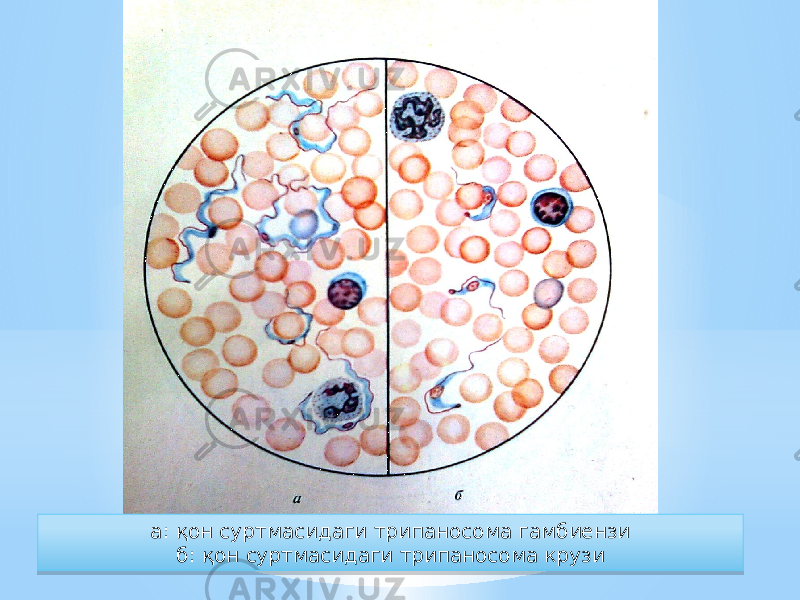 а: қон суртмасидаги трипаносома гамбиензи б: қон суртмасидаги трипаносома крузи02 16 