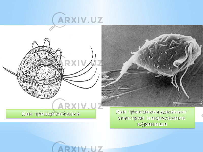 Қин трихомонадаси Қин трихомонадасининг электрон микроскопик кўриниши15 15 57 11 