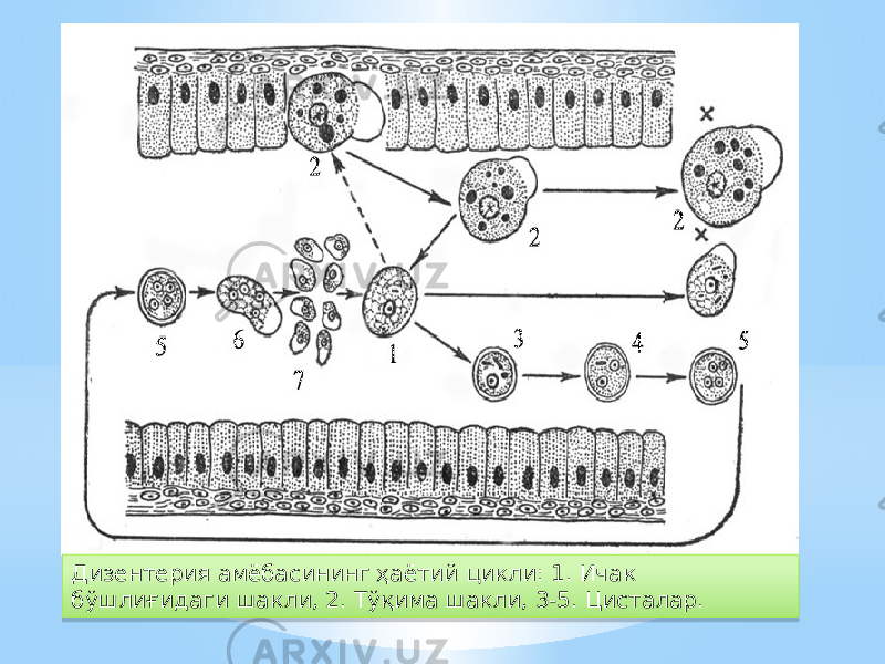 Дизентерия амёбасининг ҳаётий цикли: 1. Ичак бўшлиғидаги шакли, 2. Тўқима шакли, 3-5. Цисталар.52 16 