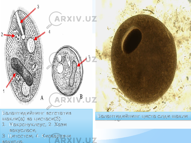 Балантидийнинг вегетатив шакли(а) ва цистаси(б): 1. Макронуклеус; 2. Ҳазм вакуоласи; 3. Цитостом; 4. Қисқарувчи вакуола; Балантидийнинг циста олди шакли35 0F 30 31 0C02 24 0C02 35 