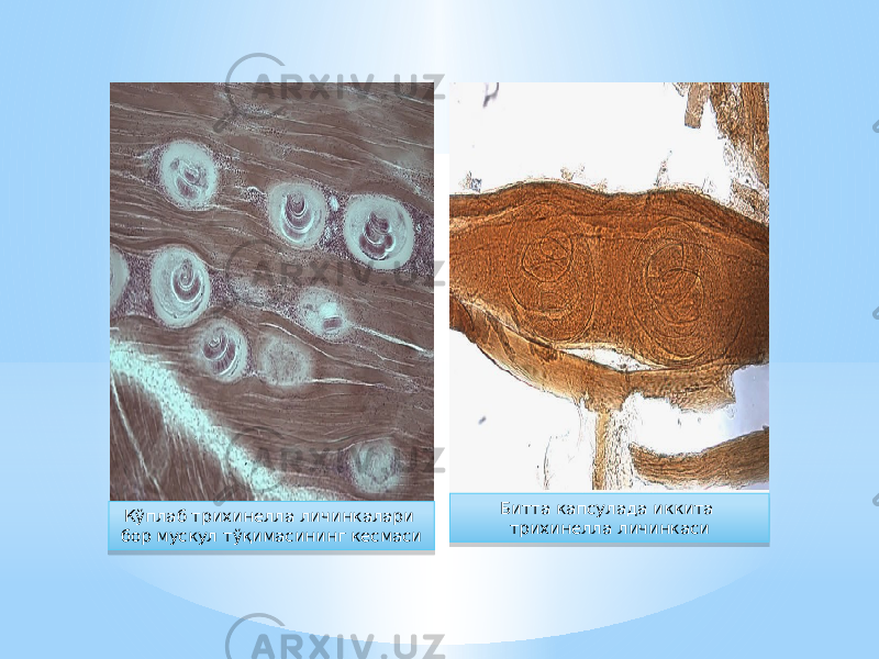 Кўплаб трихинелла личинкалари бор мускул тўқимасининг кесмаси Битта капсулада иккита трихинелла личинкаси3A 16 35 06 