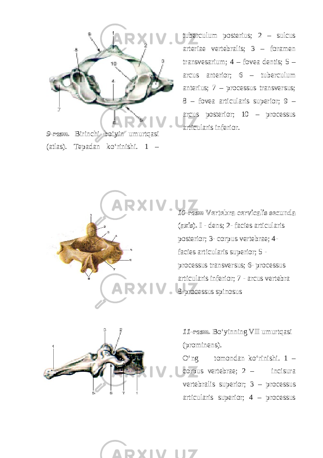9 -rasm. Birinchi bo‘yin umurtqasi (atlas). Tepadan ko‘rinishi. 1 – tuberculum posterius; 2 – sulcus arteriae vertebralis; 3 – foramen transvesarium; 4 – fovea dentis; 5 – arcus anterior; 6 – tuberculum anterius; 7 – processus transversus; 8 – fovea articularis superior; 9 – arcus posterior; 10 – processus articularis inferior. 10 -rasm Vertebra cervicalis secunda (axis). I - dens; 2- facies articularis posterior; 3- corpus vertebrae; 4- facies articularis superior; 5 - processus transversus; 6- processus articularis inferior; 7 - arcus vertebra 8-processus spinosus 11 -rasm. Bo‘yinning VII umurtqasi (prominens). O‘ng tomondan ko‘rinishi. 1 – corpus vertebrae; 2 – incisura vertebralis superior; 3 – processus articularis superior; 4 – processus 