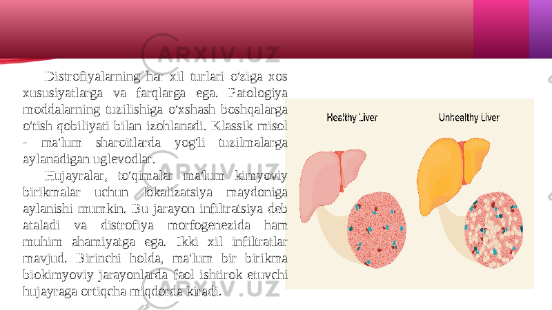 Distrofiyalarning har xil turlari o&#39;ziga xos xususiyatlarga va farqlarga ega. Patologiya moddalarning tuzilishiga o&#39;xshash boshqalarga o&#39;tish qobiliyati bilan izohlanadi. Klassik misol - ma&#39;lum sharoitlarda yog&#39;li tuzilmalarga aylanadigan uglevodlar. Hujayralar, to&#39;qimalar ma&#39;lum kimyoviy birikmalar uchun lokalizatsiya maydoniga aylanishi mumkin. Bu jarayon infiltratsiya deb ataladi va distrofiya morfogenezida ham muhim ahamiyatga ega. Ikki xil infiltratlar mavjud. Birinchi holda, ma&#39;lum bir birikma biokimyoviy jarayonlarda faol ishtirok etuvchi hujayraga ortiqcha miqdorda kiradi.  