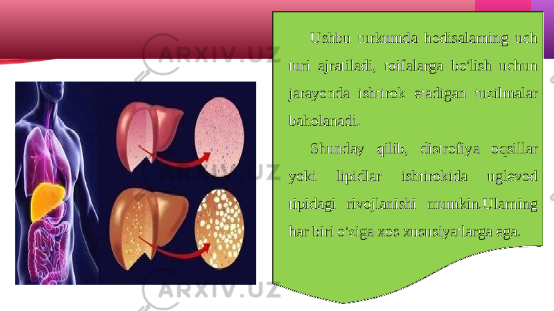 Ushbu turkumda hodisalarning uch turi ajratiladi, toifalarga bo&#39;lish uchun jarayonda ishtirok etadigan tuzilmalar baholanadi. Shunday qilib, distrofiya oqsillar yoki lipidlar ishtirokida uglevod tipidagi rivojlanishi mumkin.Ularning har biri o&#39;ziga xos xususiyatlarga ega. 