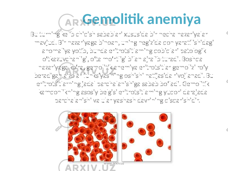 Gemolitik anemiya Bu turning kelib chiqish sabablari xususida bir necha nazariyalar mavjud. Bir nazariyaga binoan, uning negizida qon yaratilishidagi anomaliya yotib, bunda eritrotsitlaming qobiqlari patologik o‘tkazuvchanligi, o‘ta mo‘rtligi bilan ajralib turadi. Boshqa nazariyaga ko‘ra, gemolitik anemiya eritrotsitlar gemolizi ro‘y beradigan a’zolar funksiyasining oshishi natijasida rivojlanadi. Bu eritrotsitlarning jadal parchalanishiga sabab bo‘ladi. Gemolitik kamqonlikning asosiy belgisi eritrotsitlaming yuqori darajada parchalanishi va ular yashash davrining qisqarishidir. www.arxiv.uz 