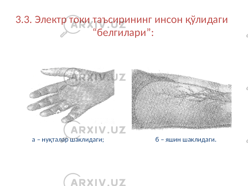 3.3. Электр токи таъсирининг инсон қўлидаги “белгилари”: а – нуқталар шаклидаги; б – яшин шаклидаги. 