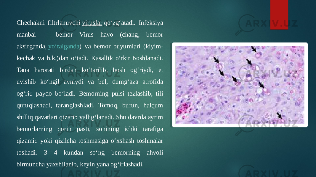 Chechakni filtrlanuvchi  viruslar  qoʻzgʻatadi. Infeksiya manbai — bemor Virus havo (chang, bemor aksirganda,  yoʻtalganda ) va bemor buyumlari (kiyim- kechak va h.k.)dan oʻtadi. Kasallik oʻtkir boshlanadi. Tana harorati birdan koʻtarilib, bosh ogʻriydi, et uvishib koʻngil ayniydi va bel, dumgʻaza atrofida ogʻriq paydo boʻladi. Bemorning pulsi tezlashib, tili quruqlashadi, taranglashladi. Tomoq, burun, halqum shilliq qavatlari qizarib yalligʻlanadi. Shu davrda ayrim bemorlarning qorin pasti, sonining ichki tarafiga qizamiq yoki qizilcha toshmasiga oʻxshash toshmalar toshadi. 3—4 kundan soʻng bemorning ahvoli birmuncha yaxshilanib, keyin yana ogʻirlashadi. 