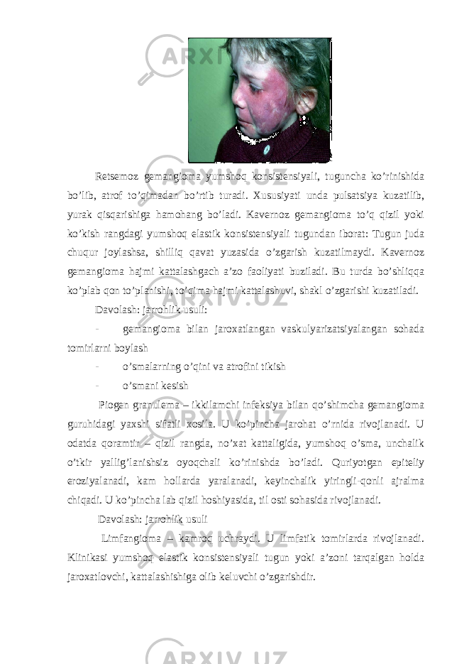  Retsemoz gemangioma yumshoq konsistensiyali, tuguncha ko’rinishida bo’lib, atrof to’qimadan bo’rtib turadi. Xususiyati unda pulsatsiya kuzatilib, yurak qisqarishiga hamohang bo’ladi. Kavernoz gemangioma to’q qizil yoki ko’kish rangdagi yumshoq elastik konsistensiyali tugundan iborat: Tugun juda chuqur joylashsa, shilliq qavat yuzasida o’zgarish kuzatilmaydi. Kavernoz gemangioma hajmi kattalashgach a’zo faoliyati buziladi. Bu turda bo’shliqqa ko’plab qon to’planishi, to’qima hajmi kattalashuvi, shakl o’zgarishi kuzatiladi. Davolash: jarrohlik usuli: - gemangioma bilan jaroxatlangan vaskulyarizatsiyalangan sohada tomirlarni boylash - o’smalarning o’qini va atrofini tikish - o’smani kesish Piogen granulema – ikkilamchi infeksiya bilan qo’shimcha gemangioma guruhidagi yaxshi sifatli xosila. U ko’pincha jarohat o’rnida rivojlanadi. U odatda qoramtir – qizil rangda, no’xat kattaligida, yumshoq o’sma, unchalik o’tkir yallig’lanishsiz oyoqchali ko’rinishda bo’ladi. Quriyotgan epiteliy eroziyalanadi, kam hollarda yaralanadi, keyinchalik yiringli-qonli ajralma chiqadi. U ko’pincha lab qizil hoshiyasida, til osti sohasida rivojlanadi. Davolash: jarrohlik usuli Limfangioma – kamroq uchraydi. U limfatik tomirlarda rivojlanadi. Klinikasi yumshoq elastik konsistensiyali tugun yoki a’zoni tarqalgan holda jaroxatlovchi, kattalashishiga olib keluvchi o’zgarishdir. 