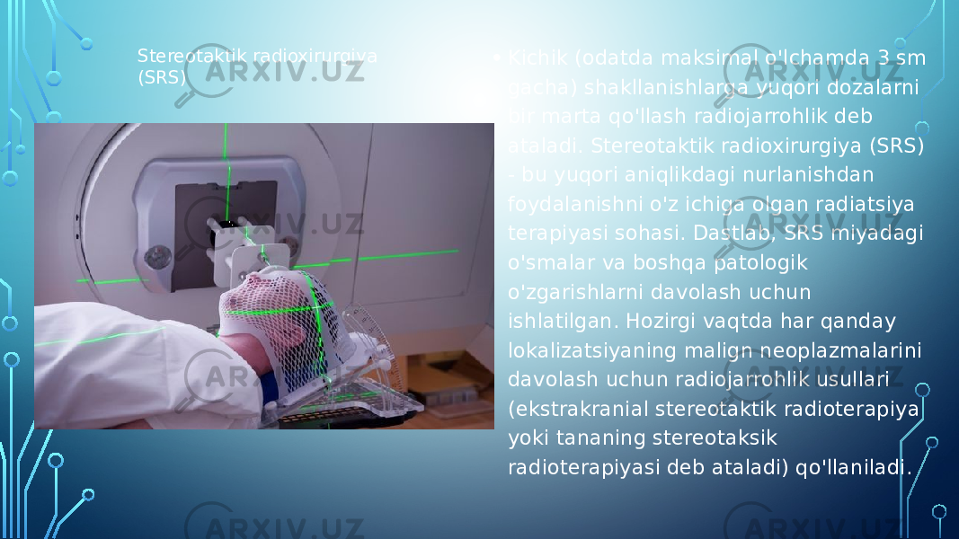 • Kichik (odatda maksimal o&#39;lchamda 3 sm gacha) shakllanishlarga yuqori dozalarni bir marta qo&#39;llash radiojarrohlik deb ataladi. Stereotaktik radioxirurgiya (SRS) - bu yuqori aniqlikdagi nurlanishdan foydalanishni o&#39;z ichiga olgan radiatsiya terapiyasi sohasi. Dastlab, SRS miyadagi o&#39;smalar va boshqa patologik o&#39;zgarishlarni davolash uchun ishlatilgan. Hozirgi vaqtda har qanday lokalizatsiyaning malign neoplazmalarini davolash uchun radiojarrohlik usullari (ekstrakranial stereotaktik radioterapiya yoki tananing stereotaksik radioterapiyasi deb ataladi) qo&#39;llaniladi.Stereotaktik radioxirurgiya (SRS) 