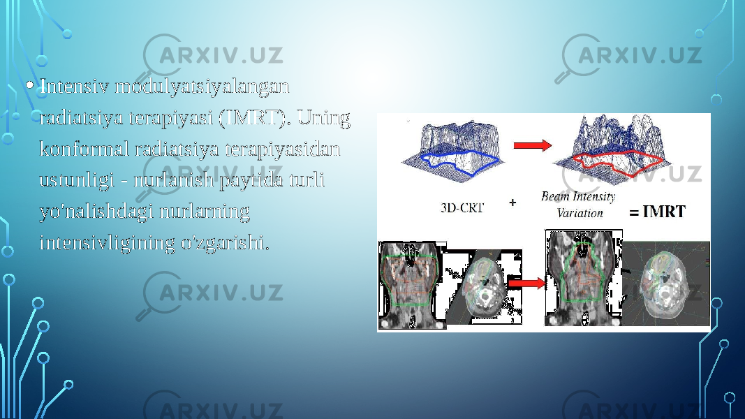 • Intensiv modulyatsiyalangan radiatsiya terapiyasi (IMRT). Uning konformal radiatsiya terapiyasidan ustunligi - nurlanish paytida turli yo&#39;nalishdagi nurlarning intensivligining o&#39;zgarishi. 